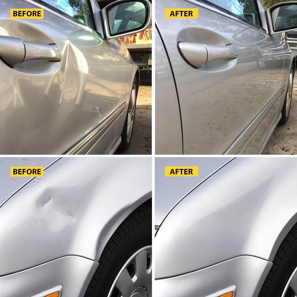 Car Dent Remover Vehicle Repair Tool Kit Pops A Dent