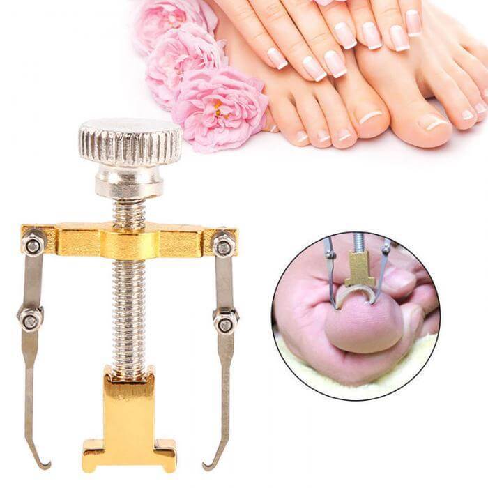 Ingrown Toe Nail Removal Bunion Corrector Pain Relief Foot Care Tool