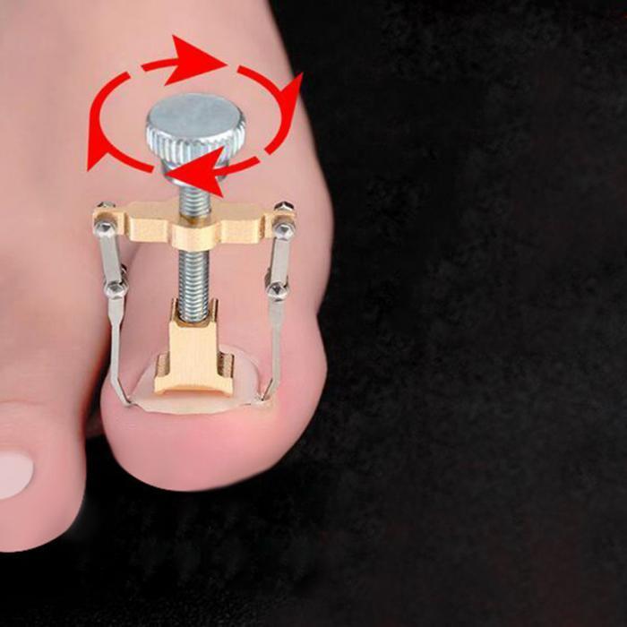 Ingrown Toe Nail Removal Bunion Corrector Pain Relief Foot Care Tool