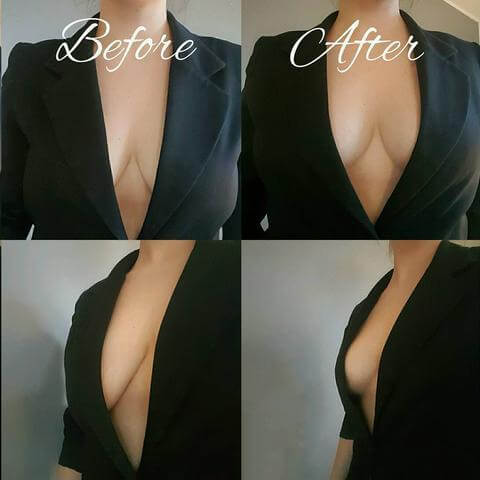 Invisible Boob Lift Tape Instant Breast Lift Tape