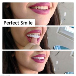 Snap On Veneers 2 Pcs Upper Lower Teeth Snap On Smile Removable