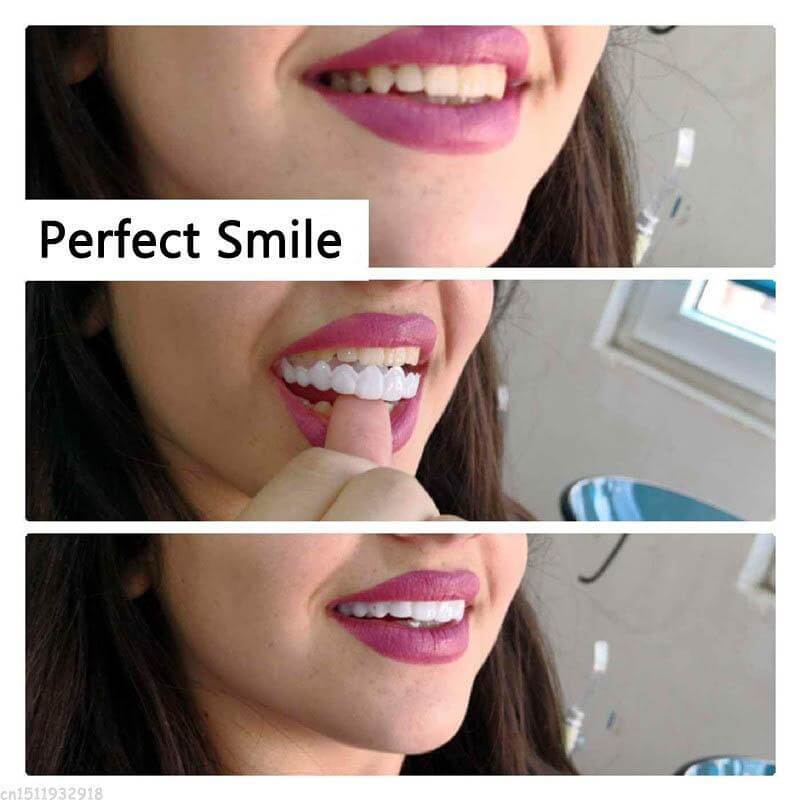 Snap On Veneers Instant Perfect Smile Comfortable Upper Teeth Cover