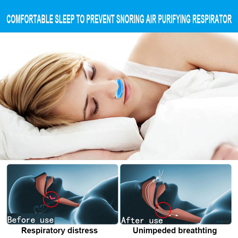 Snore Doctor- Anti Snoring Device