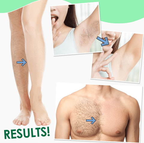  Hot Sale -50% OFF Permanent Hair Removal Spray