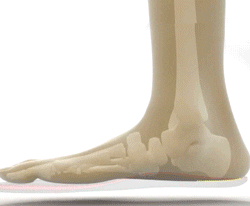 Dimleen Orthopedic Sandals
