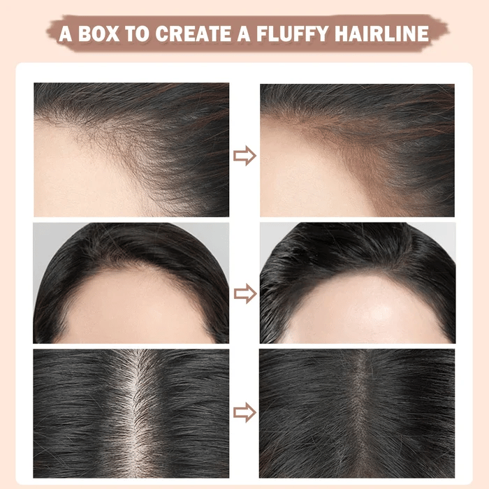 Mother's Day Hot Sale 48% OFF - Hairline Contouring