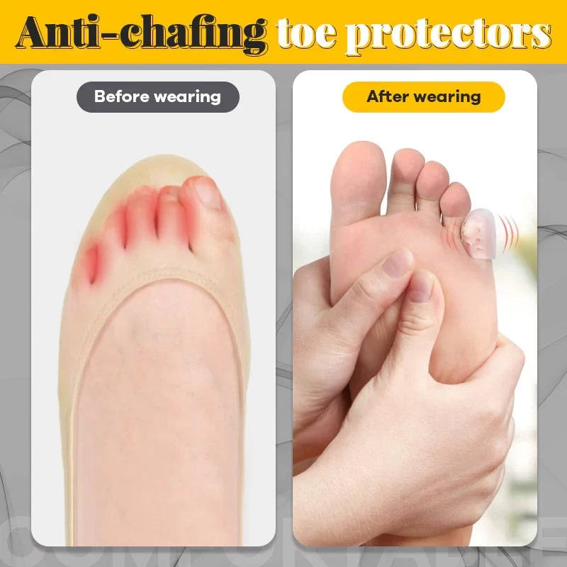 Summer Day Sales 49% OFF - Silicone anti-friction toe protector