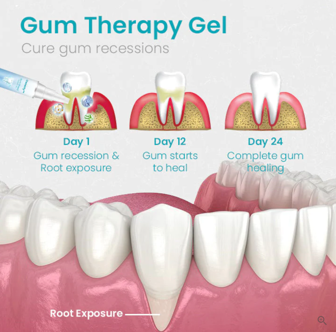 Ceoerty Gum Shield Therapy Gel